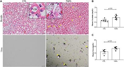 Sodium Oxalate-Induced Acute Kidney Injury Associated With Glomerular and Tubulointerstitial Damage in Rats